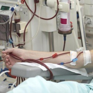Being Diabetic on Hemodialysis
