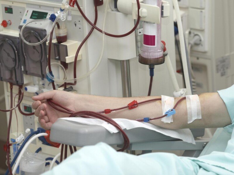 Being Diabetic on Hemodialysis