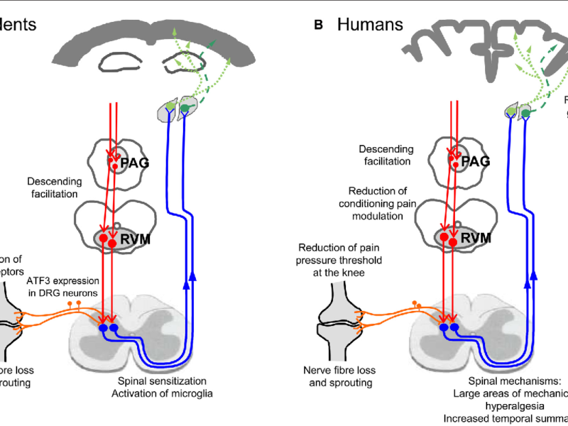 Pain Modulation and suffering of Human