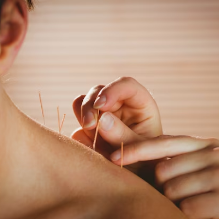 Profile picture of Grand Central Acupuncture